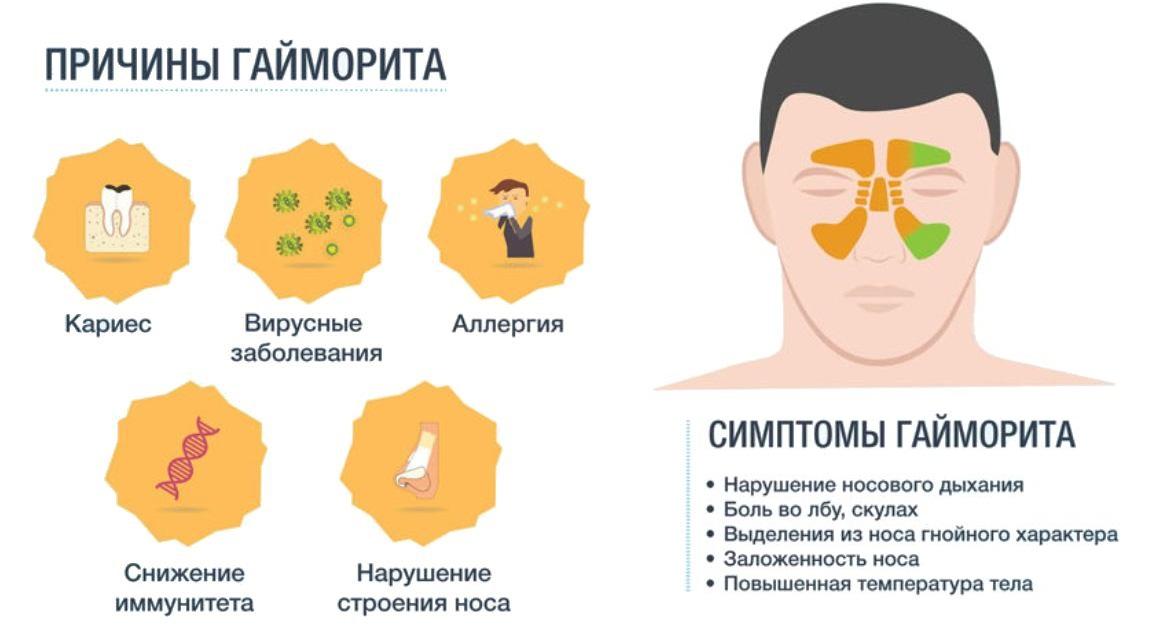 причины гайморита