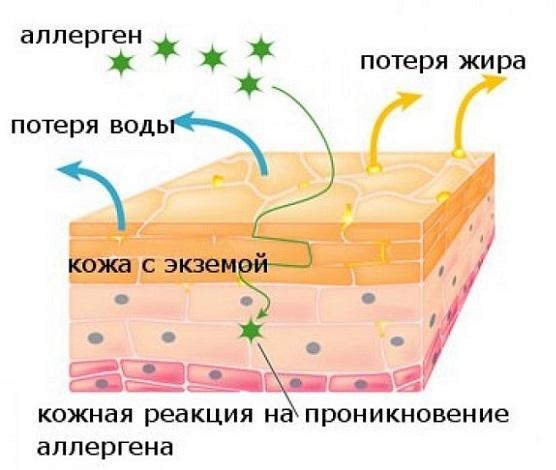 фото лечение